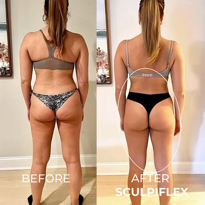 11.B&A Sculpiflex cellulite
